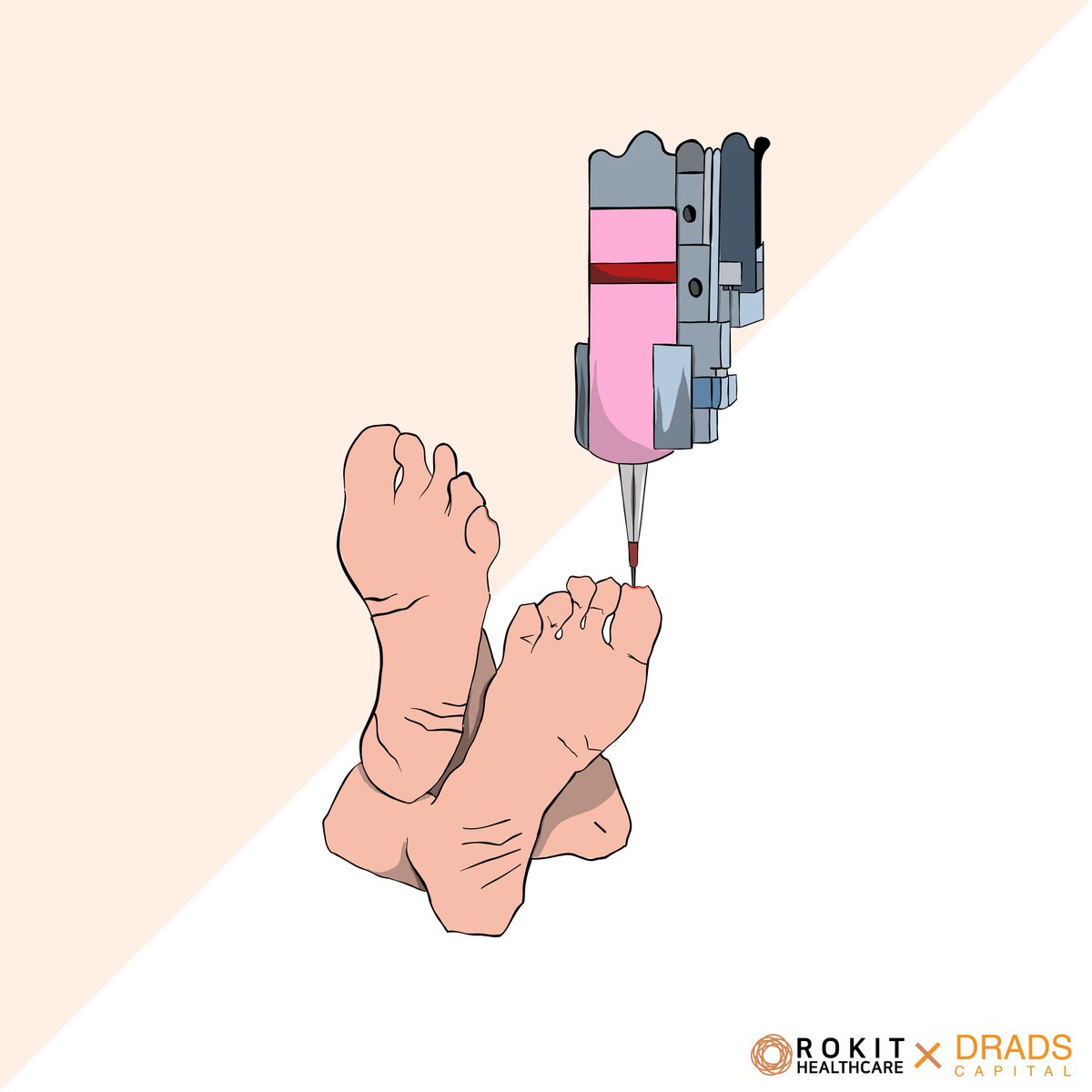 DRADS Capital (@drads_capital) on Twitter photo We have officially partnered with <a href="/ROKIT_GBD/">ROKIT_Official</a>, closing as a major Series C investor. Rokit is ushering the future of regenerative medicine with its customized artificial organ platform, and we are honored to be a part of that journey!
#Innovation #Biotechnology #VentureCapital We have officially partnered with <a href="/ROKIT_GBD/">ROKIT_Official</a>, closing as a major Series C investor. Rokit is ushering the future of regenerative medicine with its customized artificial organ platform, and we are honored to be a part of that journey!
#Innovation #Biotechnology #VentureCapital