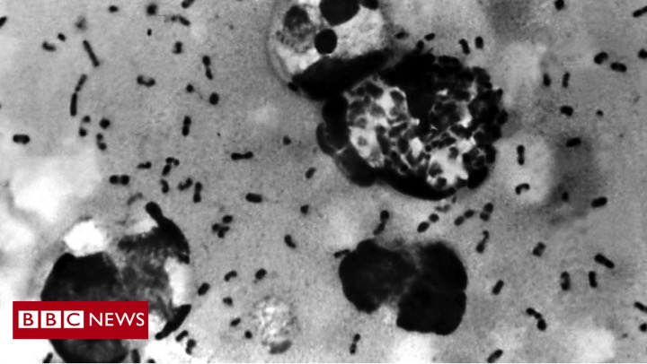 A suspected case of bubonic plague has been reported to authorities in ChinaIt’s not known how the patient got infected, but the country is on alertThe plague is one of the deadliest diseases in history, but can be treated with antibiotics[Thread] http://bbc.in/3f7eSrO 