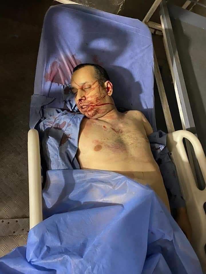 #رحمك_الله 💔🤲🥺
#بسبب_مواقفك_الشجاعه_ودفاعكم عن الحق ولا تجامل قتلوك. #شهيد_الكلمه_الحره 
#هشام_الهاشمي_شهيدا
#في_زمن_قل_فيه_المنصفين