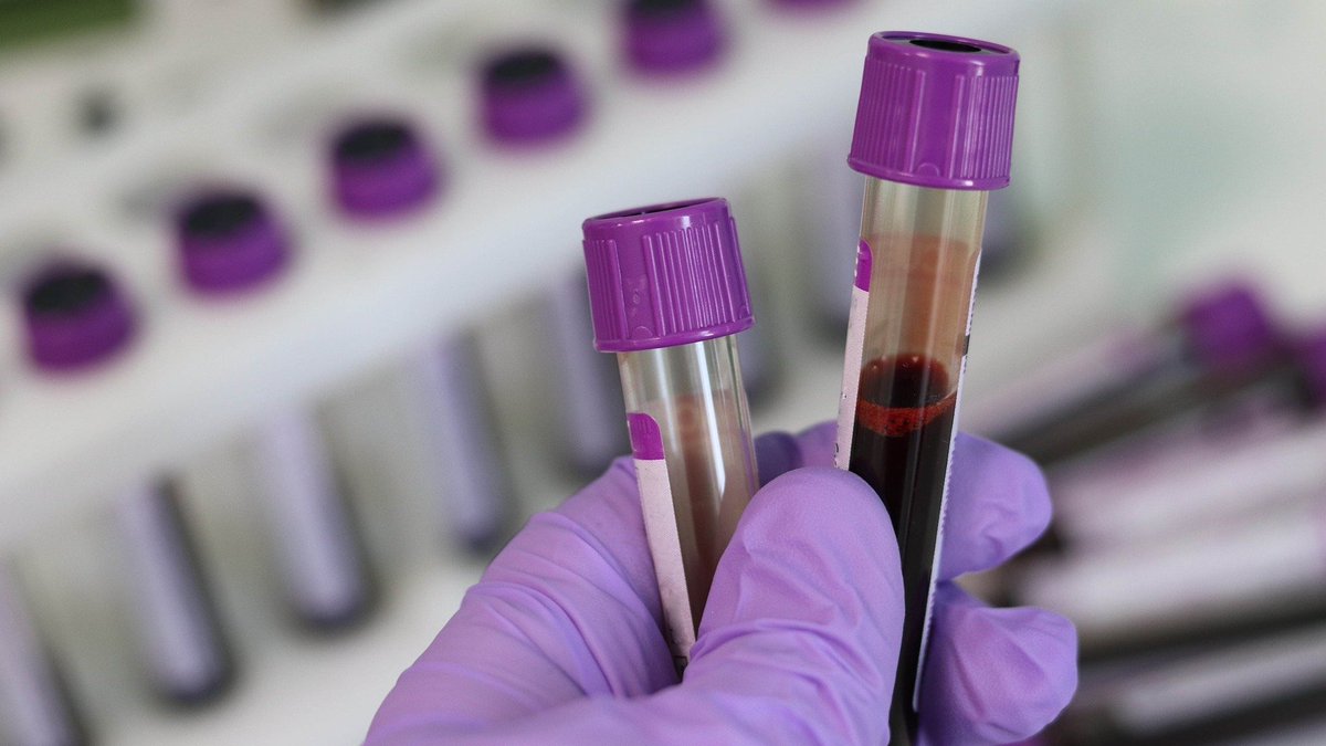 geistekpharma's tweet photo. RT @CienciaGob: Investigadores del @CSIC desarrollan un nuevo test de anticuerpos que detecta la inmunidad frente a #COVID19 con más del 98% de fiabilidad.
Fabricado por @Immunostep y disponible en hospitales en un mes y medio.
➡️ https://t.co/A8PD708XqP https://t.co/kRrn5ePdfr
