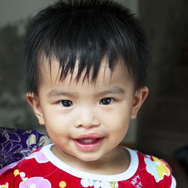 operationsmile's tweet photo. After successful #surgery, Han’s mother and grandmother were able to see her beautiful new smile for the first time. We’re thrilled to have resumed surgery safely in #Hanoi, #Vietnam so we can help more children like Han. https://t.co/BPNRRTkVcU