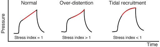 PEEP to stress index =1The same concept of inflection point where you ventilate the patient in the area with best recruitment and best compliance.Here you determine it by pressure to time wave form in volume control mood.Adjust the PEEP to get the strait pressure line.