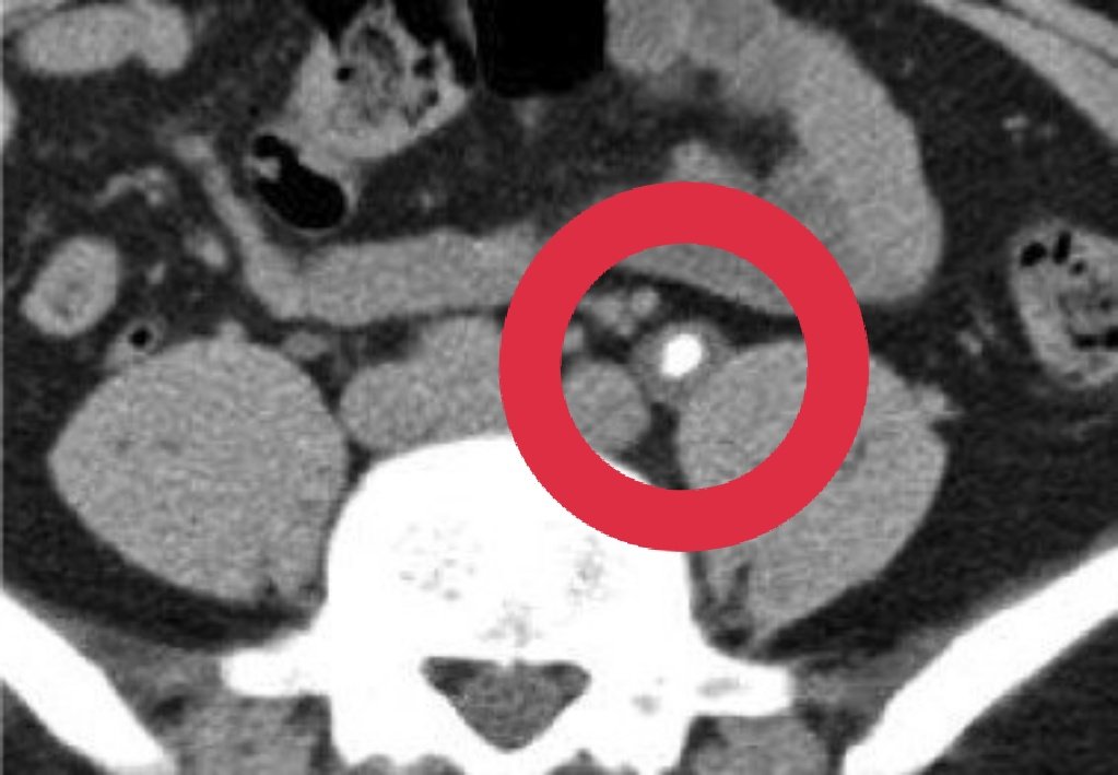 Diego Santillan tweet media