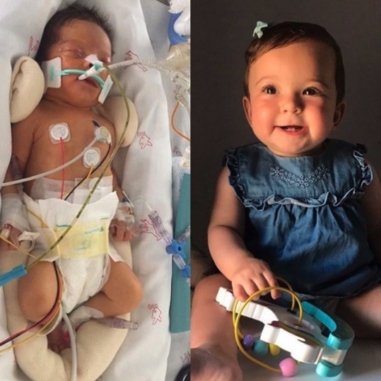 Sweet Jimena's family stayed at <a href="/SFRonald_LaPaz/">SalaFamiliarRonald_LaPaz</a> in Madrid, Spain when she came into this world, and now she is celebrating her first birthday at home! 😍💙 

#TransformationTuesday #KeepingFamiliesClose