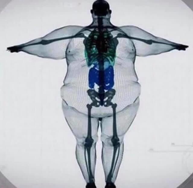 Mtrain135Mason's tweet photo. Did you know 🤔
According to the national institute of health, Obesity and overweight together are the second leading causes of preventable deaths in the United States. Estimated 300,000 deaths per year. 
#PreventionIsHealthCar https://t.co/bmmCP9bHSW