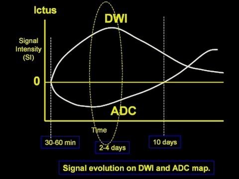 INTERNEURONA tweet media