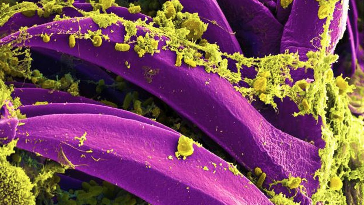 Complex's tweet photo. JUST IN: Chinese officials confirm case of Bubonic plague.

FULL STORY: https://t.co/3X0O72e0r2 https://t.co/jzkx0lERqH