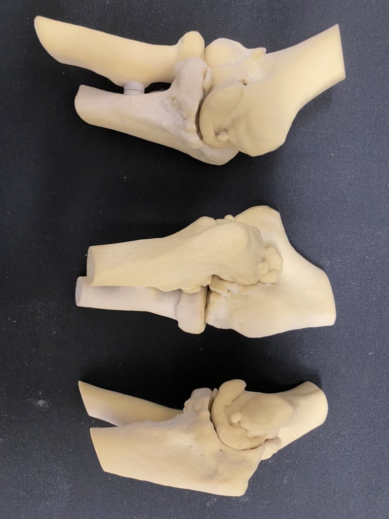 JayMorris_MD's tweet photo. Combine #3Dprinting / @MayoRadiology / #Engineering / passionate #Orthopedics surgeons like #markmorrey = improved patient care . #innovation in Elbow surgery has come though practice of what "may" be possible on #patient models @3dsystems #projet660 paraffin embedded #MEDTECH https://t.co/L9L022k4MY