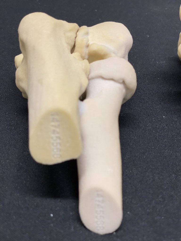 JayMorris_MD's tweet photo. Combine #3Dprinting / @MayoRadiology / #Engineering / passionate #Orthopedics surgeons like #markmorrey = improved patient care . #innovation in Elbow surgery has come though practice of what "may" be possible on #patient models @3dsystems #projet660 paraffin embedded #MEDTECH https://t.co/L9L022k4MY