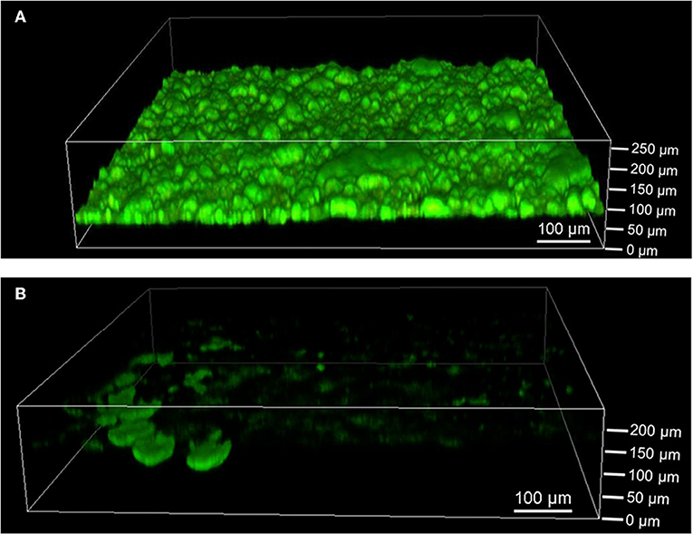 FrontiersIn's tweet photo. Researchers investigated the long-term behavior of #electrochemically active #bacteria - #GeobacterSulfurreducens and #ShewanellaOneidensis - in #bioelectrochemical systems. #Bioengineering #Biotechnology #Bioenergy

Read article in @FrontBioeng: https://t.co/xeo0yQrMts https://t.co/7wQkkDeZgb