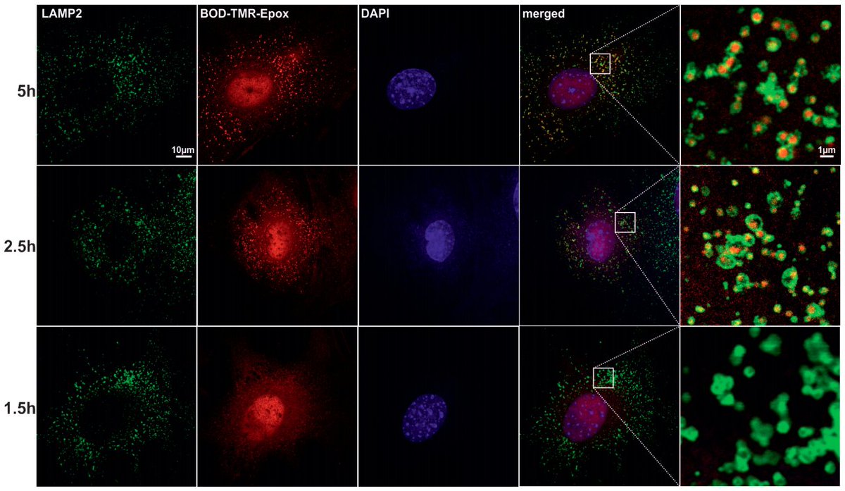 molcellprot's tweet photo. "#Proteaphagy in mammalian cells can function independent of ATG5/ATG7" – #lysosome #proteasome #proteindegradation #autophagy
https://t.co/knAJO195jK
@UniBonn https://t.co/74Glf22UXo
