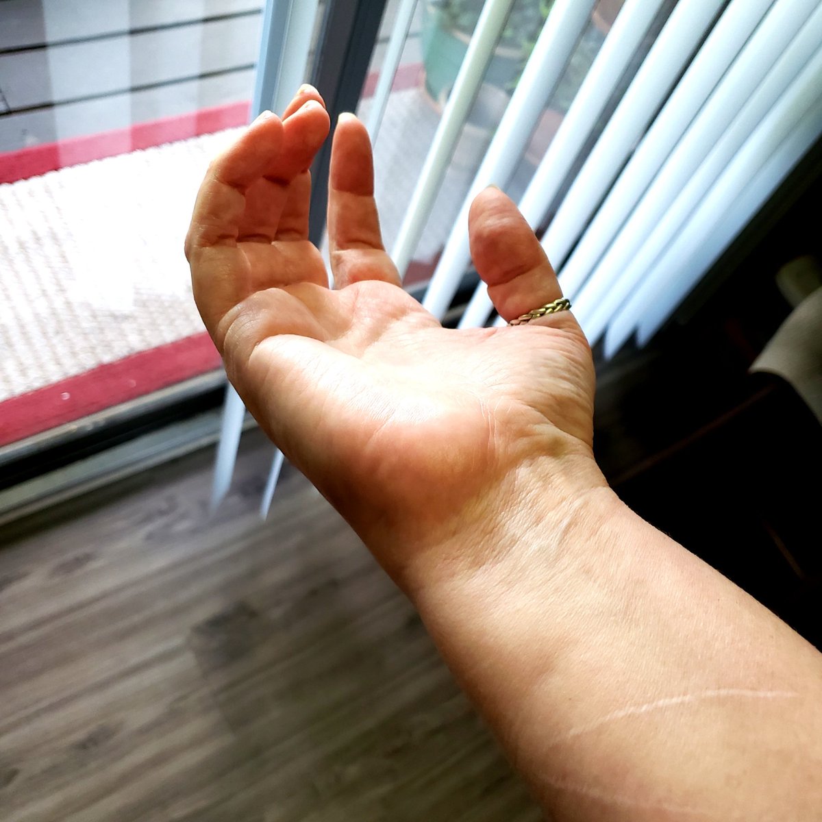 krispris's tweet image. Popped a tendon in my right right wrist. Heard it before I felt the hot pain creep into my hand and up my forearm. Luckily, I have a wrist brace from an old injury for my LEFT hand, but hey, whatever works, yes? #Owchie