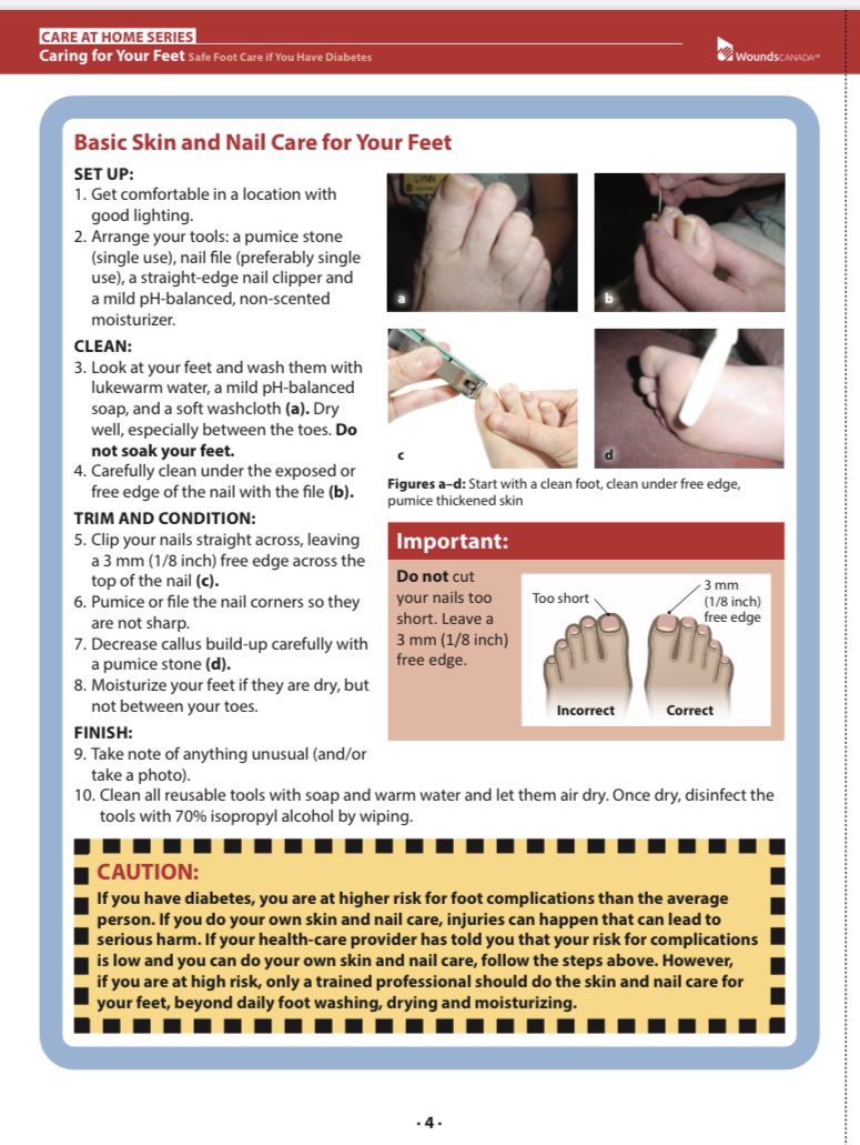 MIMOSAdx's tweet photo. Caring for and checking the skin and nails of your feet is very important for patients with diabetes.
Check out the most recent @WoundsCanada resource for safe #FootCare
https://t.co/N34D35mtUr
#CheckYourFeet #Diabetes #COVID19 https://t.co/1qmbFQj3sl