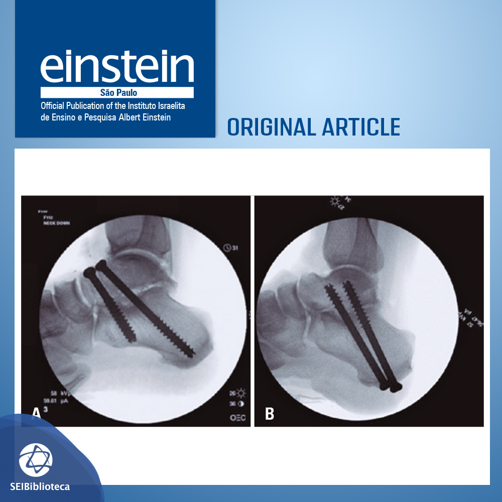 journaleinstein's tweet photo. #publishedineinstein
Biomechanical comparison of plantar-to-dorsal and dorsal-to-plantar screw fixation strength for subtalar #arthrodesis.
https://t.co/heUNTcSE7G
#journaleinstein #arthritis #jointdiseases #jointinstability #subtalarjoint #ankle https://t.co/vJ7FgVs8Jw