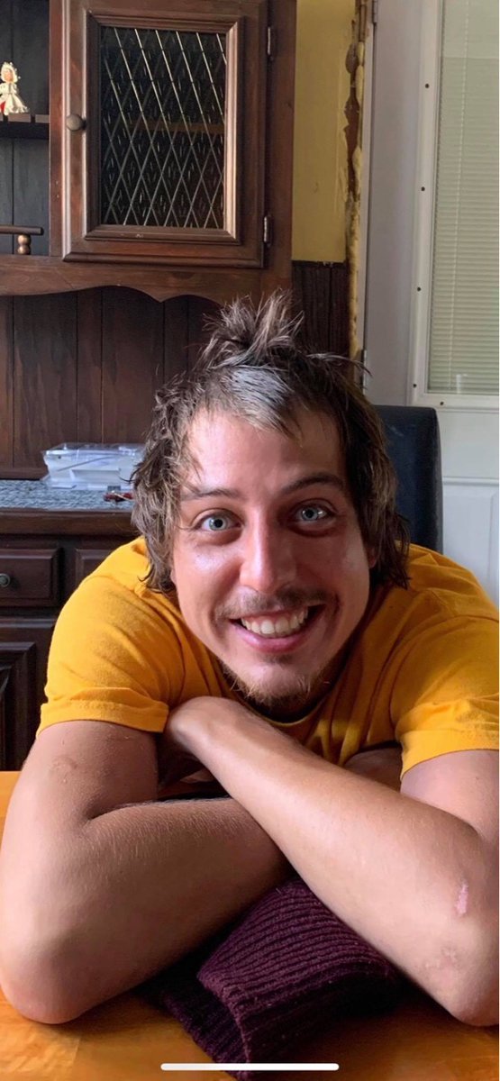 Hey friends, this is the most recent pic of my friends missing son Bryan Steckley from Fort Erie, Ont 2 days ago on a skateboard.  Pleez retweet🙏🙏🙏🙏🙏🙏🙏🙏🙏🙏
Greatly appreciated!❤ call 911 if he's seen!