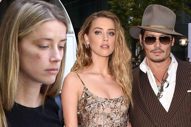 ScandalousMedia's tweet photo. Amber Heard tried to sleep with Johnny Depp after accusing him of abusive and violent behavior publicly AND after getting an active restraining order against him. She really was trying to manipulate him into sleeping with her so she can supposedly accuse him of rape... https://t.co/UUeUoIByHk