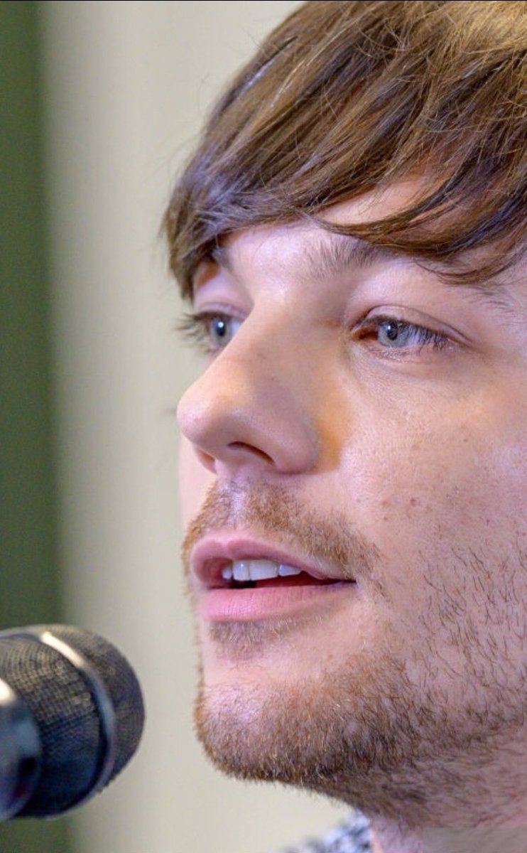 en esta foto se pueden apreciar claramente las imperfecciones que louis tomlinson no tiene