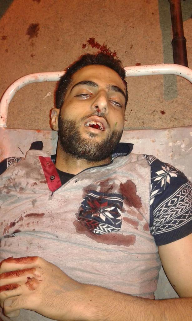 ajit_gupta03's tweet photo. Trending #BurhanWani is like;
कोई और भी है जो 72 हुरों से मिलने की जल्दी मे है!
#TerroristBurhanWani
#IndianArmy will send you very soon there #terroristPakistani!!!
#ProudToBeAnIndian 🙏
So think again, Don't mess with #India
बाकी आप की मर्ज़ी!!!! https://t.co/MT4FQTE2ck