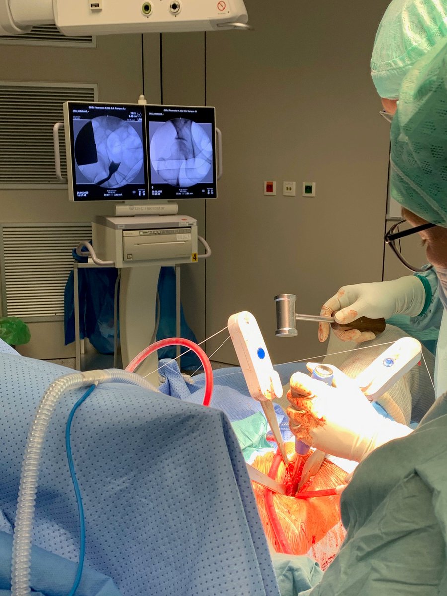 MedEnvision's tweet image. In these challenging times with lack of staffing, the Gripper provided a solution for this surgeon who could help 2 patients with a complex periacetabular osteotomy(PAO), with the assistance of only one scrub nurse.

#Gripper #EsySuit #EsySolution #Standardization #Efficiency