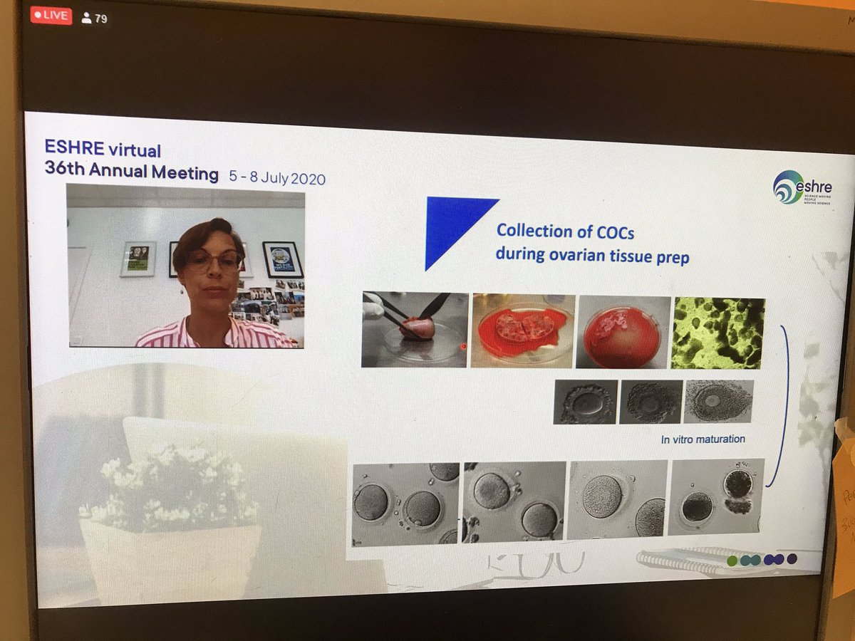 alteri_ale's tweet photo. Dr. Kelly Tilleman, the Coordinator of @ESHREsigSQART talking about In Vitro Matured Oocytes found during oVArian tissues preparation (IViMOVA) @TillemanKelly #ESHRE2020 #ESHREvirtual #ESHREsigSQART #SafeLearningWithESHRE
#SafeWithESHRE @theESHRE5 https://t.co/ZB8ra7iQmC