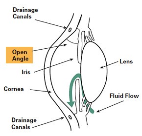 UbatOhUbat's tweet photo. Open-angle glaucoma has a wide and open angle between the iris and cornea. It is caused by the slow clogging of the drainage canals, resulting in increased eye pressure.
#openangle https://t.co/VSDKx6DwOY