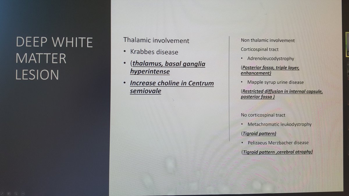 griz1's tweet photo. Summary of findings to help recognition of leukodystrophies. 
@uclapedsneuro Noon Conf #PNNC by #DrGShrestha! @UCLAMCH @PedNeurBriefs @CNS_Connect @JChildNeurol @Child_Neurology @meeryo @KidsBrainsDrO @Drjonsantoro @JohnMillichapMD @TheASNR #WhiteMatterMatters #GizaPedNeuro https://t.co/DAUa2dgjwj