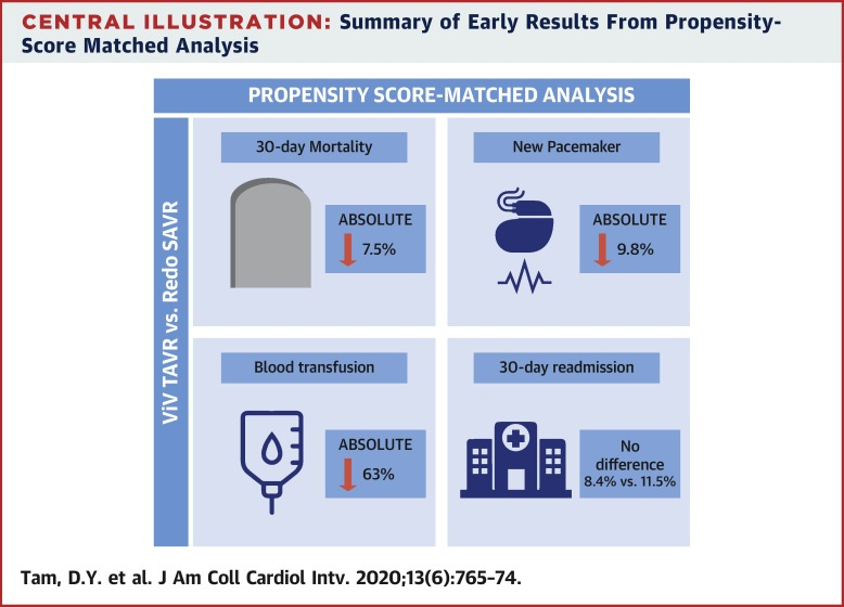 TAVI is the standard procedure for failing bioprosthetic aortic valves.