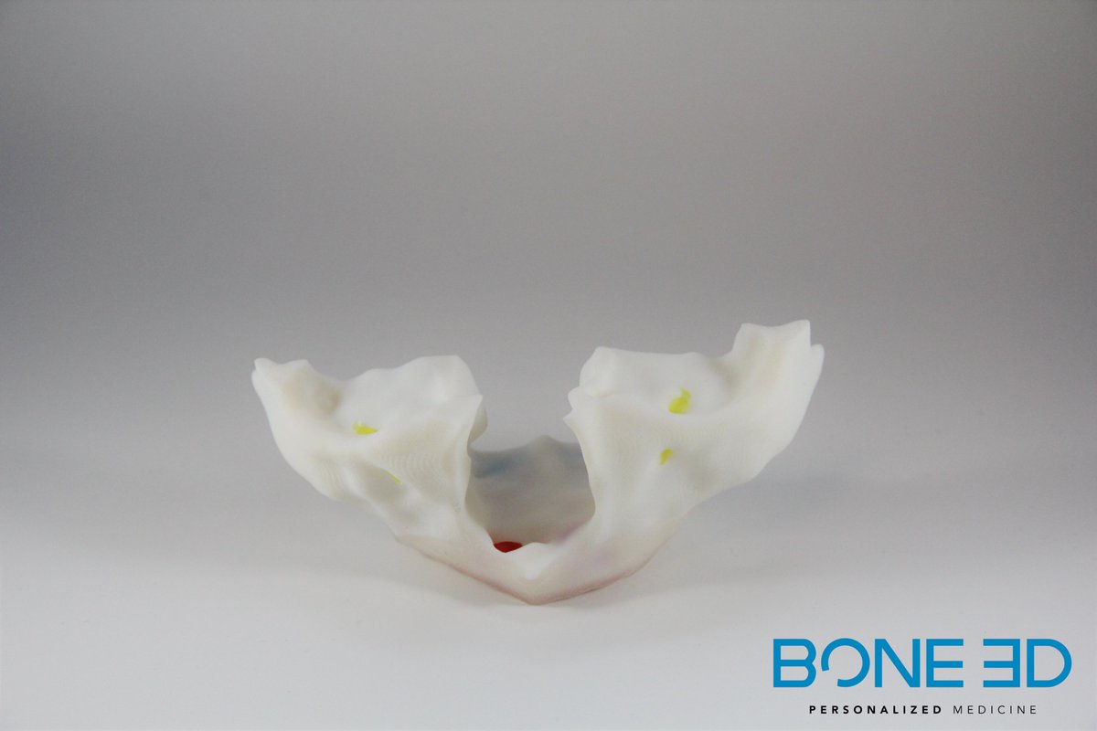 BONE_3D's tweet photo. Notre nouveau modèle de simulateur de pose d'implant zygomatique est disponible! Il constitue un outil pédagogique hyper réaliste sur lequel vous pourrez réaliser différents actes essentiels au traitements des édentés complets.
#medtech #3dprinting #surgerysimulator #oralsurgery https://t.co/ZPhqAdBQYd