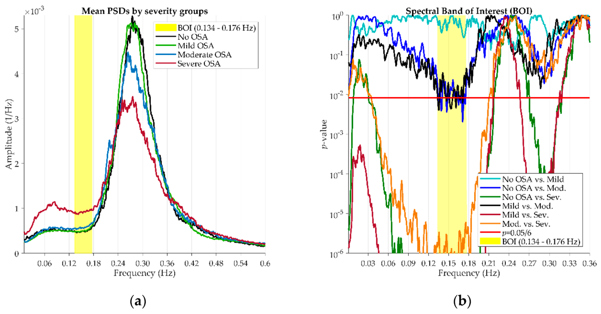 Entropy_MDPI's tweet photo. #mdpientropy "Assessment of Airflow and Oximetry Signals to Detect Pediatric Sleep Apnea-Hypopnea Syndrome Using AdaBoost" https://t.co/CeHlypZHHn
#sleepapnea–#hypopneasyndrome
#airflow
#oximetry
#AdaBoost
#spectralanalysis
#nonlinearanalysis https://t.co/wbiNHrFbCS