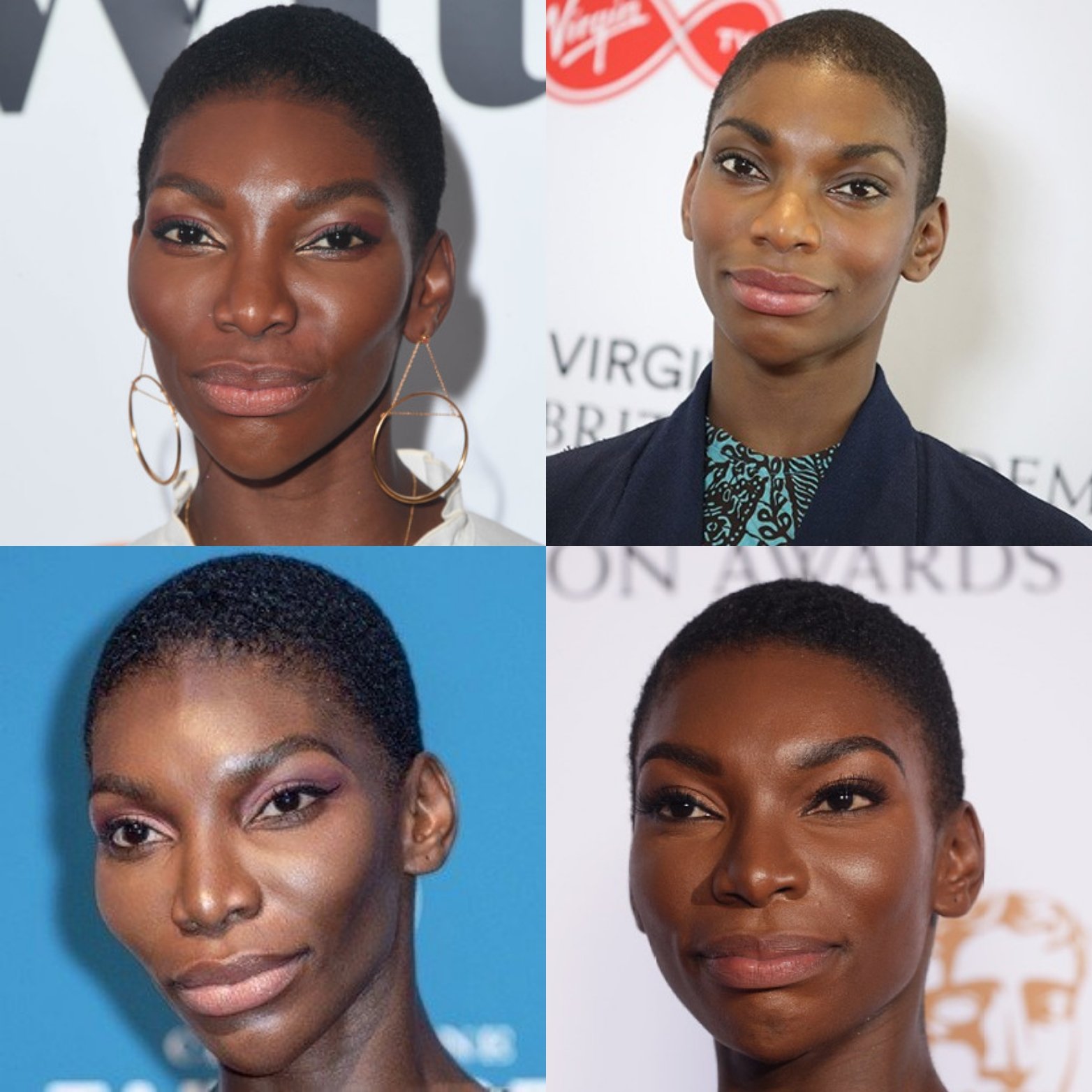 Michelle Obama Nose Job