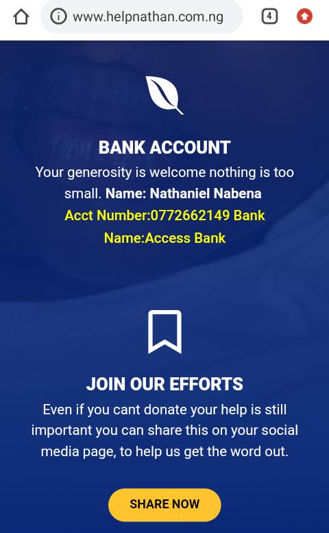 myst_sings's tweet photo. i beg you all in the name of God to help RT. this little boy, Nathaniel, has a tumour behind his eye that keeps pushing it out. after several surgeries, his parents can't handle this alone anymore. please help in any way you can. he is my niece's sch mate. God bless you!!! https://t.co/EEDeOgFqJv