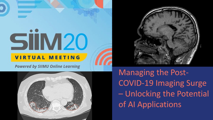icometrix's tweet image. How to tackle Post-COVID-19 medical imaging surge? #Siim20 Virtual Meeting webinar shows #Blackford platform with #icometrix as partner, unlocking #AI potential. #icobrain & #icolung increase radiologists productivity reading routine & complex exams. bit.ly/3iKyTXd
#MRI