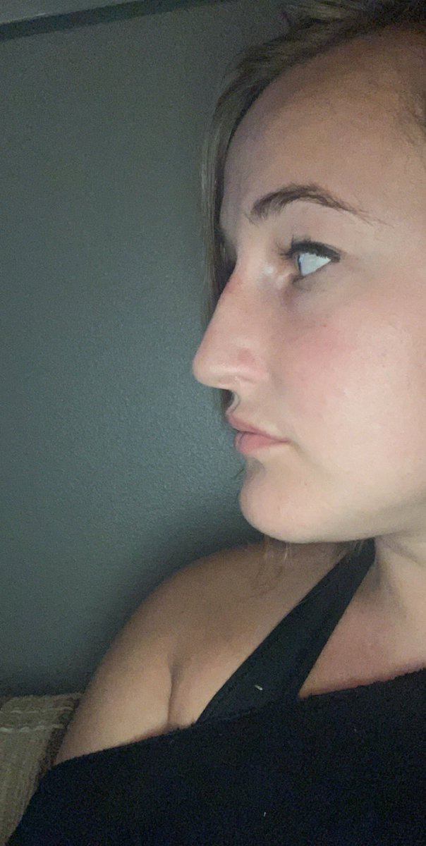 _ipatch1's tweet image. I HAVE BEEN SO INSECURE BECAUSE OF MY NOSE MY ENTIRE LIFE AND WANTED A NOSE JOB SINCE I WAS 7...I AM LITERALLY SO OBSESSED RN 🥺😭😍