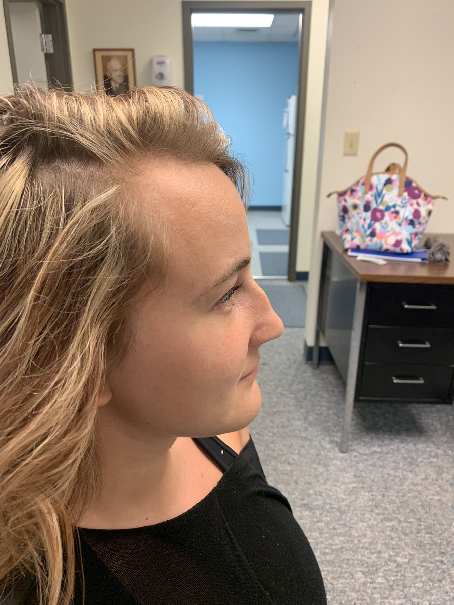 _ipatch1's tweet image. I HAVE BEEN SO INSECURE BECAUSE OF MY NOSE MY ENTIRE LIFE AND WANTED A NOSE JOB SINCE I WAS 7...I AM LITERALLY SO OBSESSED RN 🥺😭😍