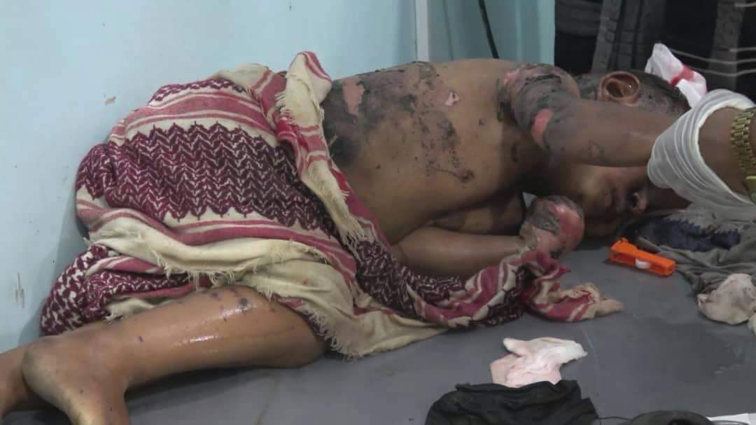 بعض من أسماء الشهداء والجرحى..
الي استهدفهم طيران العدوان السعودي الإماراتي الأمريكي الإسرائيلي البريطاني  اليوم بالجوف..
#حسبناالله ونعم وكيل
#جريمة_المساعفة_الحزم_الجوف