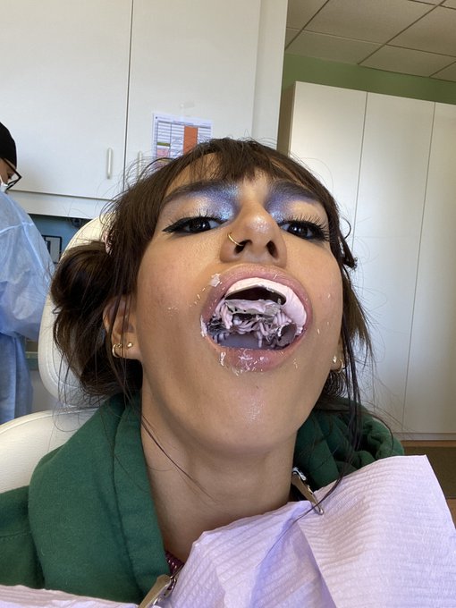 love to need 40k worth of dental work https://t.co/mWQBF7GhBv