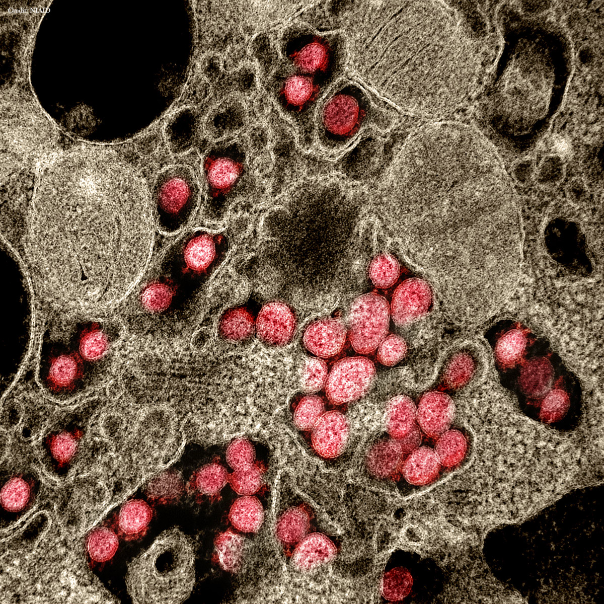 Science Magazine (@sciencemagazine) on Twitter photo .<a href="/PennMedicine/">Penn Medicine</a> researchers studying immune responses of 125 hospitalized #COVID19 patients identified three distinct “Immunotypes,” work that could inform which therapeutic interventions may be most useful in specific patients. fcld.ly/47p6jxh .<a href="/PennMedicine/">Penn Medicine</a> researchers studying immune responses of 125 hospitalized #COVID19 patients identified three distinct “Immunotypes,” work that could inform which therapeutic interventions may be most useful in specific patients. fcld.ly/47p6jxh