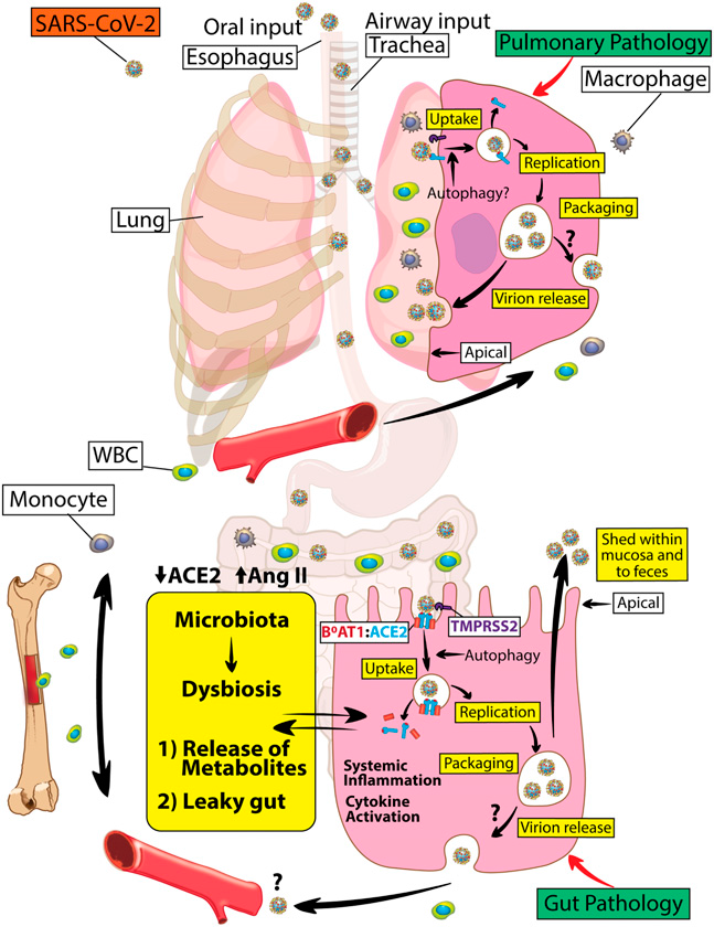 SARS-CoV-2 Infections and ACE2: Clinical Outcomes Linked With Increased Morbidity and Mortality in Individuals With Diabetes
diabetes.diabetesjournals.org/content/early/…
#COVID19 #SARS #coronavirus #SARS_CoV_2 #diabetes