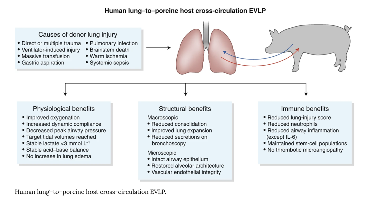 AhmedHozain's tweet photo. @NatureMedicine News and Views by Drs. Andrew Fisher and John Dark on the future potential of xenogeneic cross-circulation. https://t.co/MLs5e8IPaQ
#lungs #CrossCirculation @GVNlab @MatthewBacchet1 https://t.co/glNrin8YUg