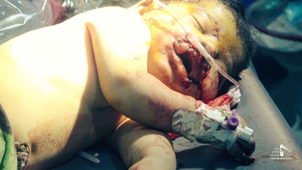 إية العالم المنافق الصامت على مايجري لأطفالناءفي اليمن من مجازرومذابح والله العظيم ستندمون وستحرقون بدمائهم اما نحن  متوكلين على الله وصابرين ومدافعين عن اليمن ولا عد يهمنا شي في هذه الحياه ولكن يكون بعلمكم إن الزمن دوار حسبي الله ونعم الوكيل #مجزرة_المرازيق_بالجوف من قبل أمريكاء