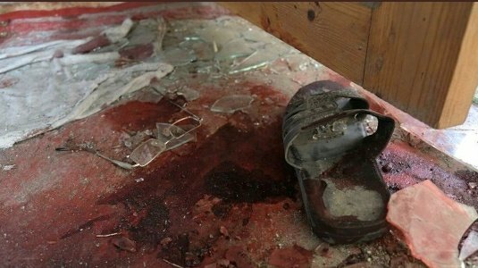 GulnarIva2's tweet photo. Günahsız kəndlilərin yaşadığı evləri atəşə tutacaq qədər aciz millət-#Armenian 
#StopArmenianOccupation 
#StopArmenianAgression https://t.co/uP76m8HIpf