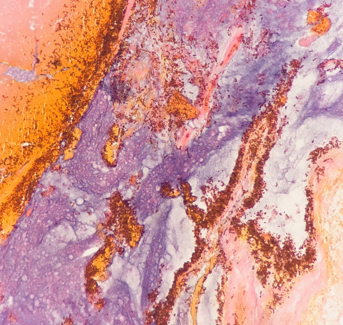 Hezhen Ren tweet media