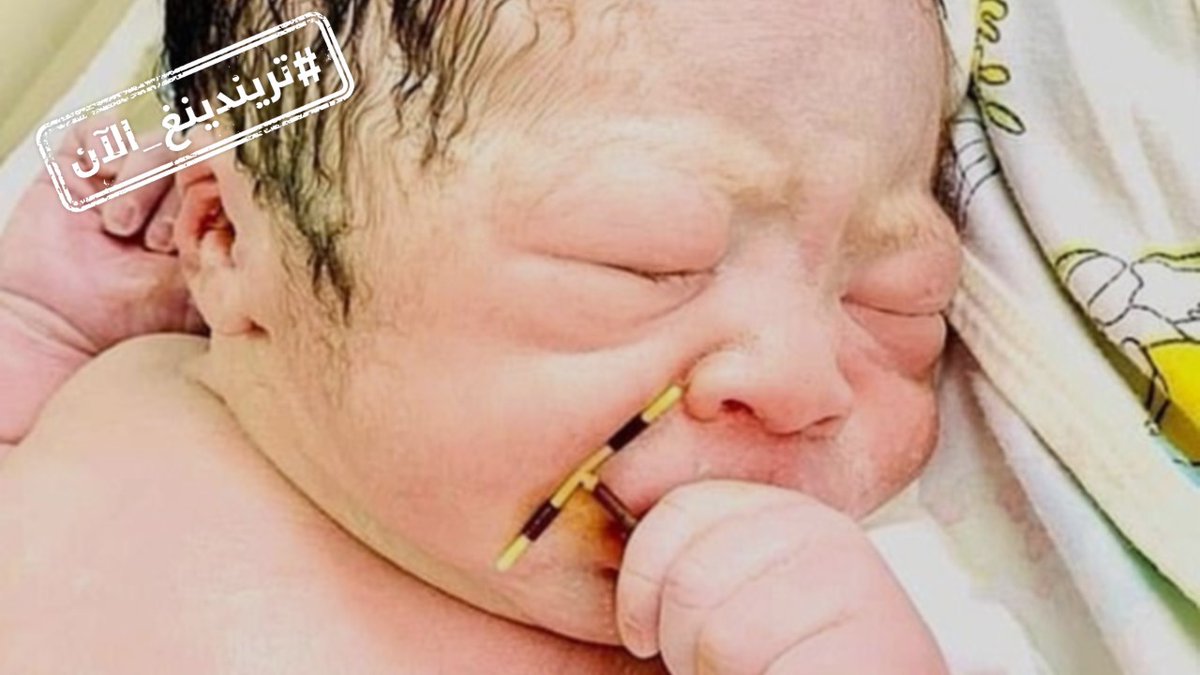 تريندينغ الآن مولود يحمل جهاز منع الحمل في يده سابقة من فيتنام طفل حديث الولادة يحمل في يده لولب منع الحمل استخدمته أمه البالغة من العمر 34 عاما منذ عامين لكن إرادة الحياة عند