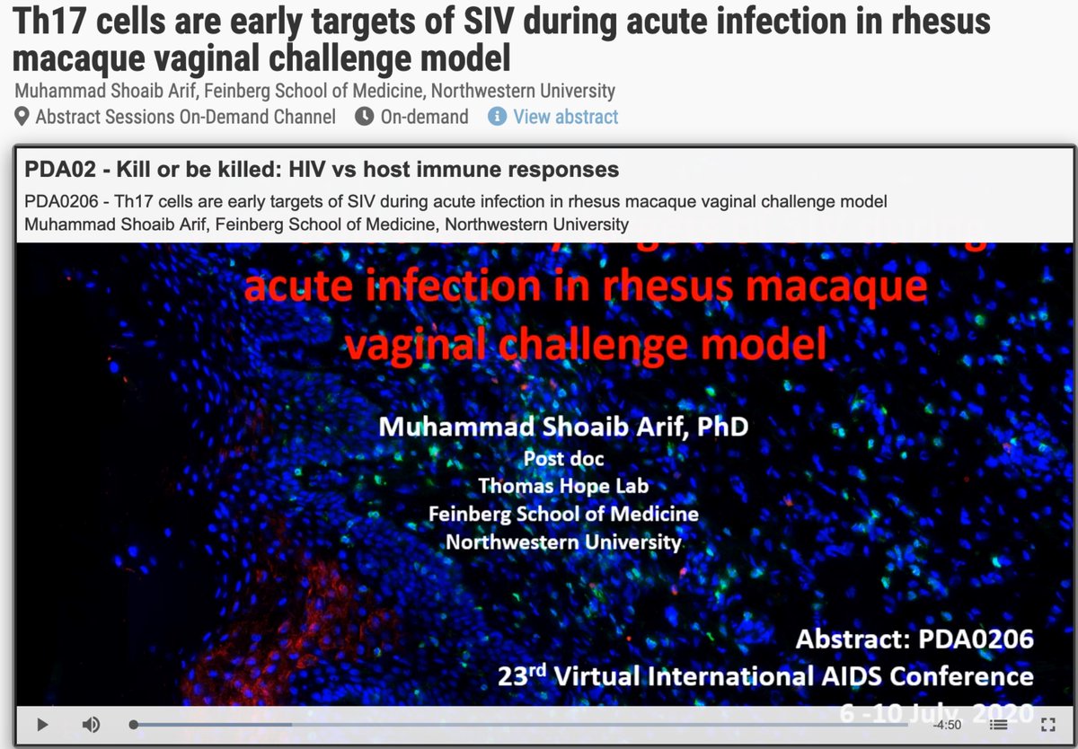 Laboratory of Dr. Thomas Hope - NU_CDB, NU_FSM (@hopelab_nu) on Twitter photo This week, <a href="/mshoaib_arif/">Shoaib</a>, virtually presented his recent research on early cellular targets of SIV infection at AIDS2020! Social-distancing science at its best! #AIDS2020Virtual #sciencefromhome #Science This week, <a href="/mshoaib_arif/">Shoaib</a>, virtually presented his recent research on early cellular targets of SIV infection at AIDS2020! Social-distancing science at its best! #AIDS2020Virtual #sciencefromhome #Science