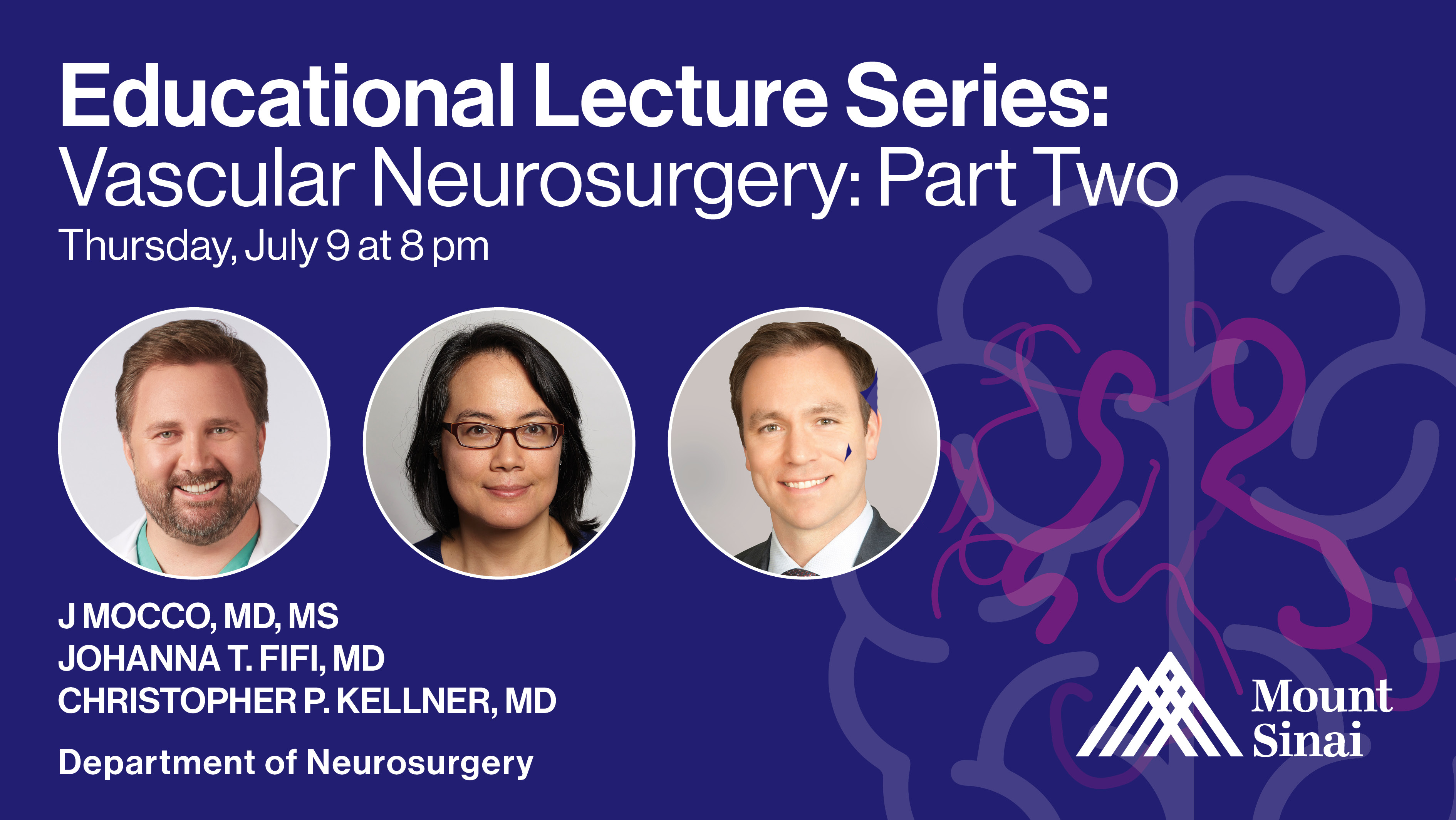 Mount Sinai Neurosurgery Educational Lecture Series: Vascular Neurosurgery: Part Two Thursday, July 9 at 8 pm J Mocco, MD, MS Johanna T. Fifi, MD Christopher P. Kellner, MD