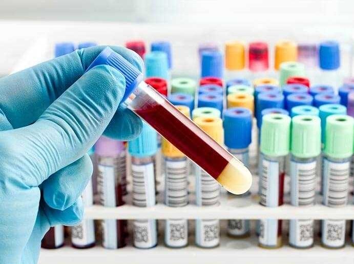 MusahLab's tweet photo. Our lab has been awarded Core Facility grant to support our work on the discovery of new #biomarkers for #human #kidneydisease. This include funds for the Sequencing and Genomics Technologies Core &amp; the Proteomics and Metabolomics Core Facilities. Thank you, @DukeU!
#MusahLab https://t.co/HjbPmc0Qqb