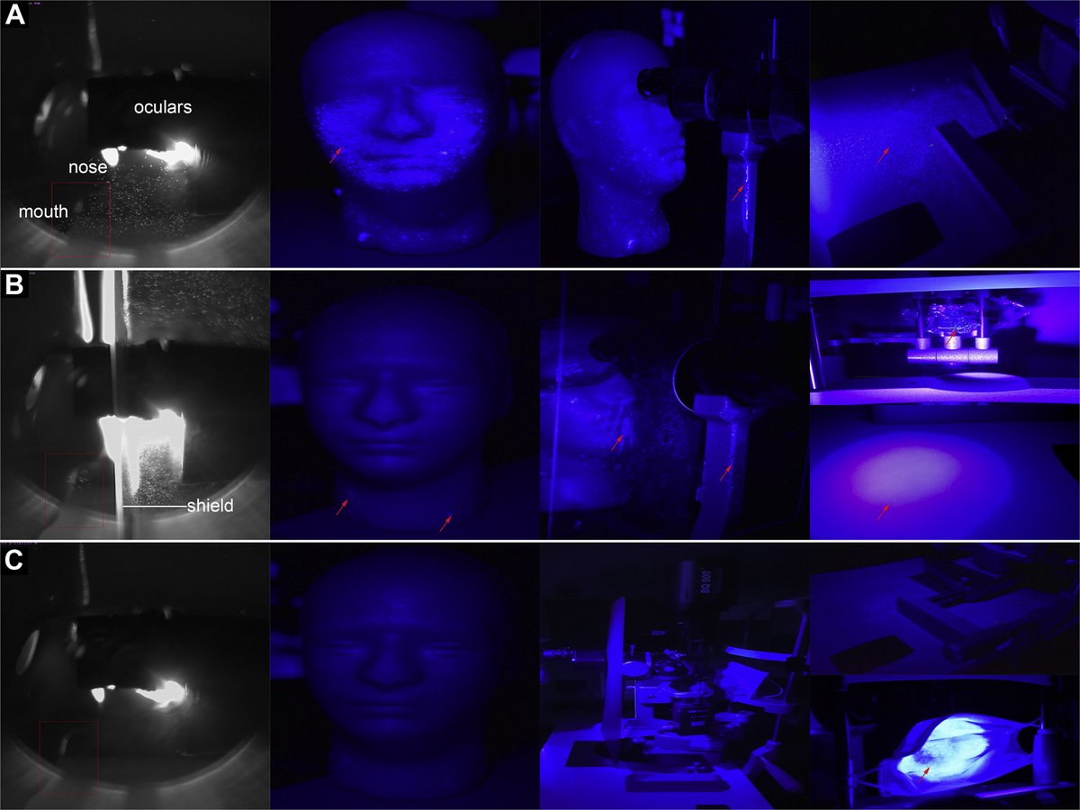Unlike face masks which provide protection from both aerosols &amp; droplets, slit lamp shields confer protection only against direct large droplet transmission with limited role in reducing aerosol transmission risk <a href="/szeechuan/">Szechuan Ong</a> #ophthalmology #COVID19 #PPE  ow.ly/a6ag50AqFva