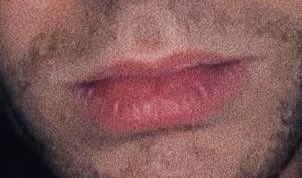 lips: