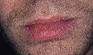 lips: