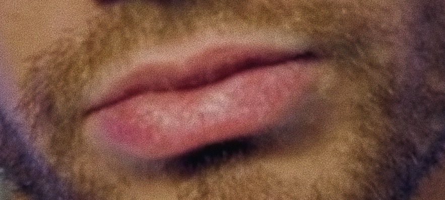 lips: